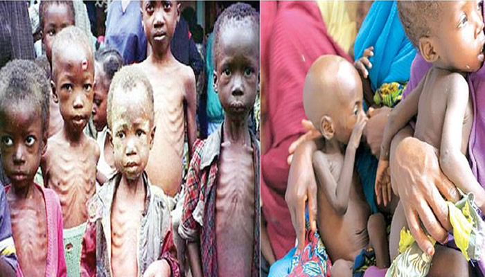 MALNUTRITIONED CHILDREN